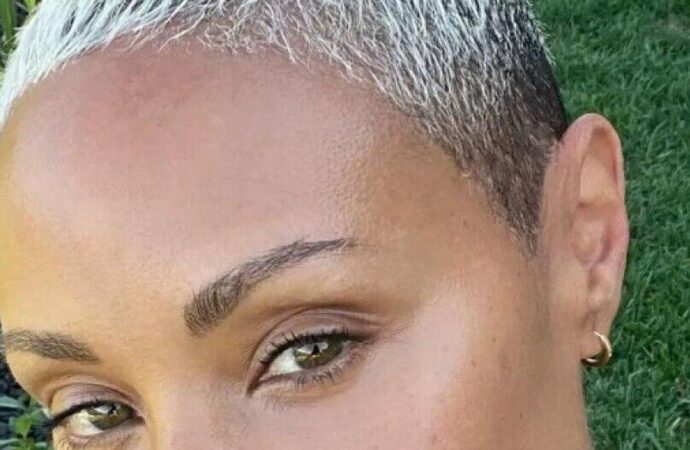Jada Pinkett Smith’s Alopecia Takes a Positive Turn: A Surprising Update on Her Journey